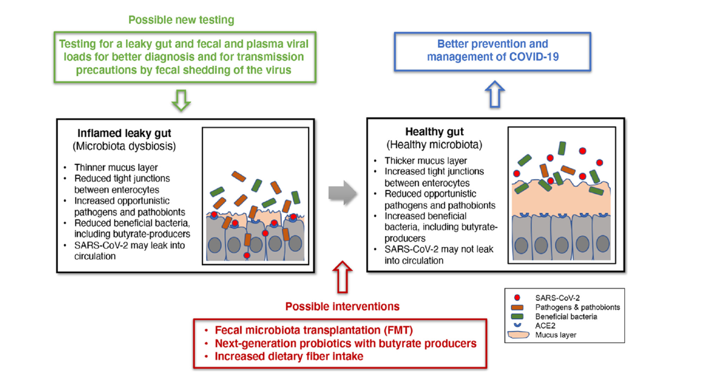 Relationship between nutrition, immunity, gut microbiota and COVID-19-gutmicrobiotaforhealth.ir