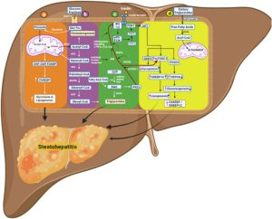 Current Pathogenic Paradigm and Therapeutic Aspect in Non-Alcoholic Fatty Liver Disease